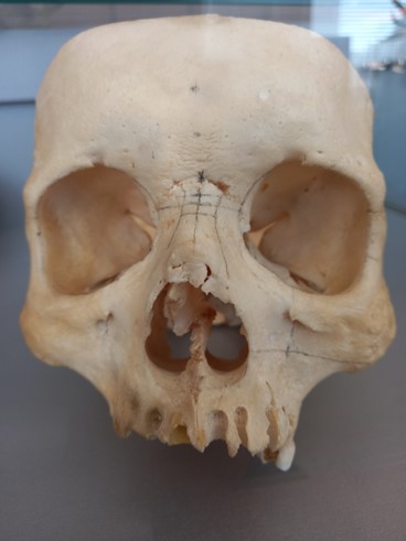 Череп человека (лат. cranium)